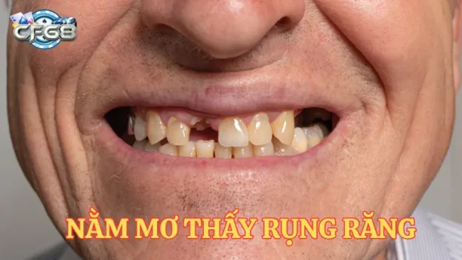 Giải mã giấc mơ thất rụng răng